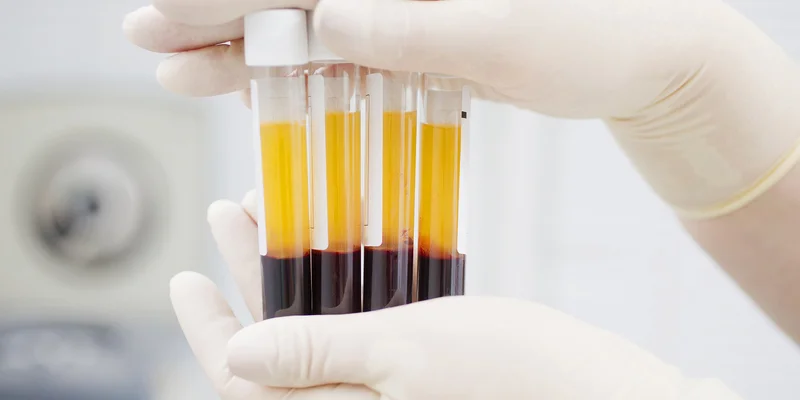 What's In a Skin Booster? PRP, PDRN, Exosome & HA Explained 2 PRP platelet-rich plasma skin booster injection