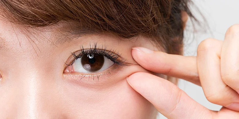 Wrinkles Around Eyes: 5 At-Home Fixes That Actually Help 1 Treating wrinkles around eyes at home with eye cream