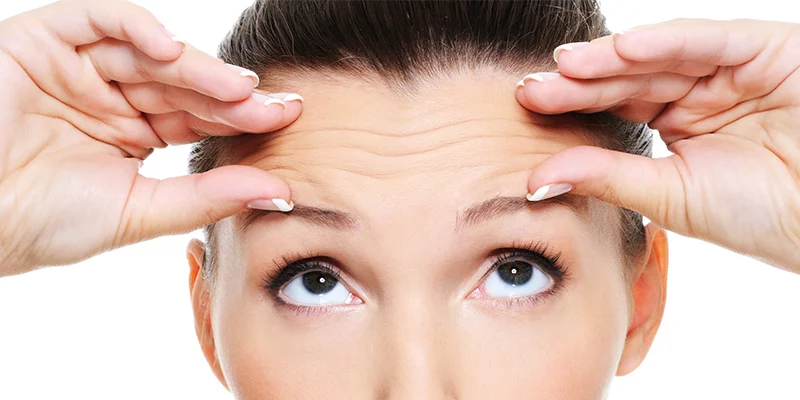 Horizontal Forehead Lines: Causes and Treatments That Work 1 Horizontal forehead lines when raising the eyebrows